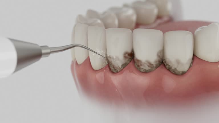 Trusted Wisdom Tooth Removal service in Half Moon, NC - Dentist Open Now